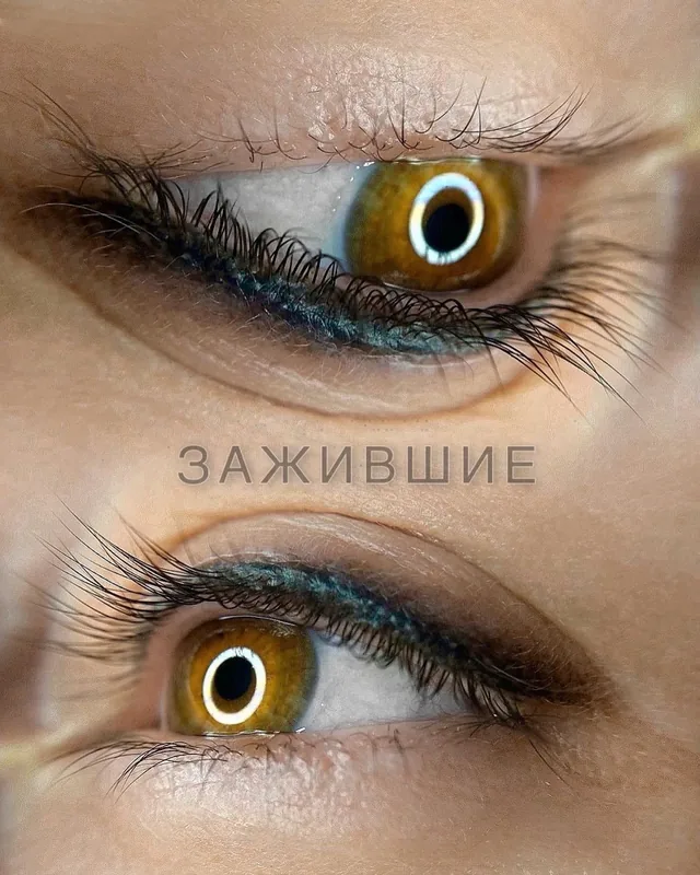 Веки
